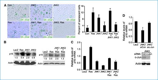 Figure 3. JNK2 prevents Ras-induced cell senescence. A, staining for senescence-associated acidic β-galactosidase [β-Gal(+) cells; blue]. Columns, average percentages of β-Gal(+) cells; bars, SD. B, semiquantitative immunoblotting for p16 with protein lysates from transduced primary human keratinocytes. Relative optical densitometry is shown below each p16 band. C and D, quantitative RT-PCR for p16 with total RNA isolated from cells transduced as in A with or without additional treatment with siRNA oligonucleotides targeting c-Jun (sic-Jun) or nonsilencing control (siCon). Gene silencing of c-Jun was confirmed by immunoblotting for c-Jun with actin as control, as shown below the graph. Columns, average of triplicate experiments; bars, SD. Expressions of the exogenous proteins in A to D were confirmed by immunoblotting (Supplementary Fig. S2B).