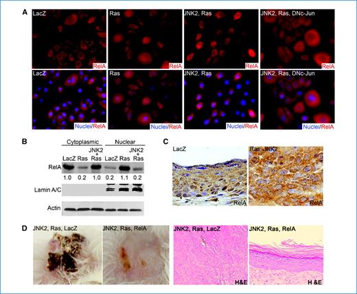 Figure 4. JNK2 inhibits Ras-induced NF-κB activation. A, immunofluorescence staining of RelA in human keratinocytes expressing genes noted on top of each image (orange, RelA; blue, nuclei). Magnification, ×120. B, semiquantitative immunoblotting with cytoplasmic and nuclear protein extracts for RelA with actin and nuclear marker lamin A/C as controls. Relative optical densitometry is shown below each RelA band. C, immunostaining of RelA on regenerated human skin tissues expressing LacZ or JNK2 and Ras (brown, RelA; blue, nuclei). D, clinical and histologic appearances (magnification, ×50) of regenerated human skin grafts. Expressions of the exogenous proteins in A to D were confirmed by immunoblotting (Supplementary Fig. S4A).