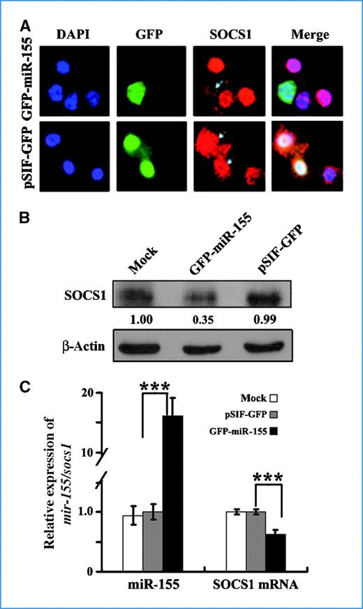 Figure 1. socs1 is a target of miR-155 in breast cancer cells. A, socs1 expression was examined by immunofluorescence analysis. GFP–miR-155 and pSIF-GFP showed transfection of miR-155 expression (top) or control vectors (bottom), respectively. Red, SOCS1 protein was immunostained with anti-SOCS1; blue, nuclei were stained with DAPI. GFP images (green) and arrowheads indicate cells with miR-155 expression or control vectors. B, SOCS1 protein levels were examined by Western blot analysis, and β-actin served as an internal reference. C, the levels of miR-155 and SOCS1 mRNA were quantified by qRT-PCR analysis. U6 and β-actin served as internal normalized references for miR-155 and SOCS1 mRNA, respectively. Columns, mean of three separate experiments; bars, SE. ***, P < 0.001.