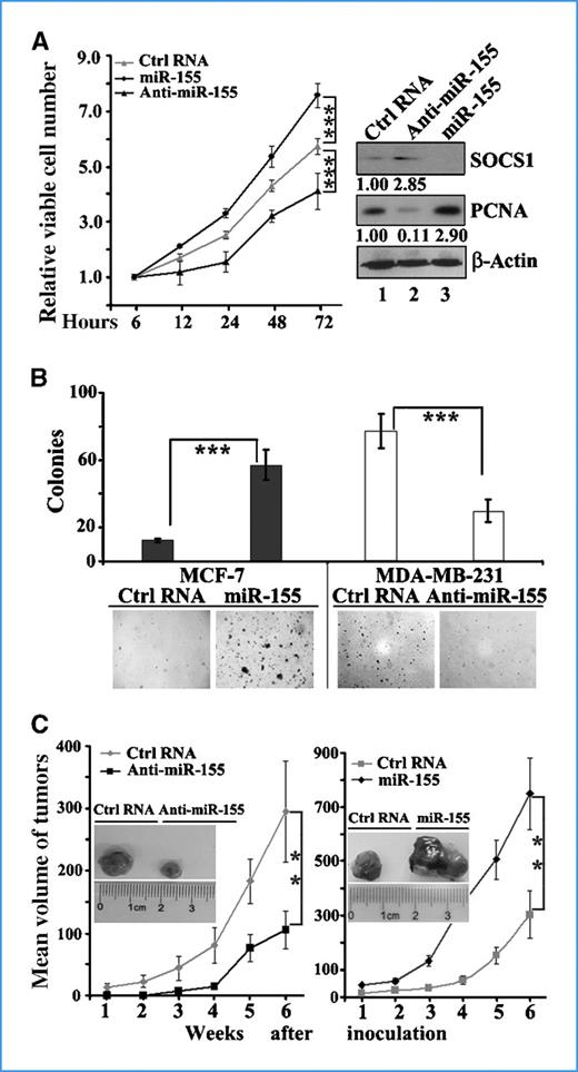 Figure 4. miR-155 acts as an oncomiR in breast cancer cells in vitro and in vivo. A, miR-155 promotes breast cancer cell proliferation. MDA-MB-231 cells were transfected with miR-155 mimics, anti–miR-155, or control RNA (Ctrl RNA). MTT assays were performed at the indicated time points after transfection. Western blot analysis was performed 72 h after transfection. B, miR-155 promotes anchorage-independent growth of breast cancer cells. MCF-7 cells were transfected with miR-155 mimics or control RNA; MDA-MB-231 cells were transfected with anti–miR-155 or control RNA. Soft agar colony formation assays were performed 24 h after transfection. C, miR-155 stimulates tumor growth of breast cancer cells in nude mice. MDA-MB-231 cells were transfected with miR-155 mimics, anti–miR-155, or control RNA. Twenty-four hours after transfection, 2 × 106 cells were injected orthotopically into the mammary fat pads of female nude mice. The curves show the time course of tumor growth, and the inset photographs are representative xenografted tumors 6 wks after inoculation. Points, average of three separate experiments; bars, SD. **, P < 0.01; ***, P < 0.001.