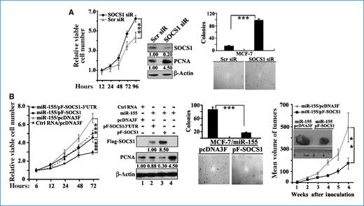 Figure 5. Targeting socs1 is involved in the oncogenic function of miR-155 in breast cancer cells. A, RNAi knockdown of socs1 recapitulates the oncogenic effect of miR-155. MCF-7 cells were transfected with SOCS1 siRNA (SOCS1 siR) or scrambled siRNA (Scr siR). Left, cell proliferation assay; right, soft agar colony formation assay. B, socs1 expression inhibits the oncogenic function of miR-155. Left, cell proliferation assay. MDA-MB-231 cells were cotransfected with miR-155 mimics and pF-SOCS1, pF-SOCS1-3′UTR, or control. Middle, soft agar colony formation assay. MCF-7 cells were cotransfected with miR-155 mimics and pF-SOCS1 or control. Right, xenograft assay in nude mice. MDA-MB-231 cells were cotransfected with miR-155 mimics and pF-SOCS1 or control. Points, mean of three separate experiments; bars, SD. **, P < 0.01; ***, P < 0.001.