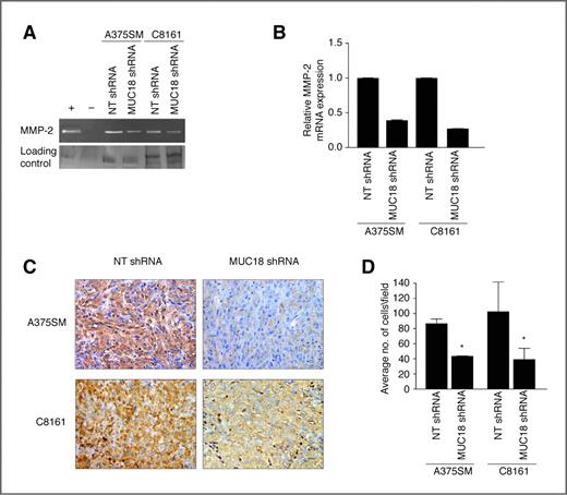 Figure 2. Effect of MUC18 silencing on melanoma cell invasion and MMP-2 expression. A, zymography shows decreased MMP-2 activity after MUC18 silencing in both A375SM and C8161, compared with NT-transduced cells. Control of zymography gel shows equal loading of samples as indicated by silver staining. Images are representative of 3 experiments. B, quantitative real-time PCR validates diminished MMP-2 expression following MUC18 silencing in both A375SM and C8161, compared with NT-transduced cells (*, P < 0.001). Expression values are illustrated as fold change of mean values ± SEM of 3 independent experiments in each cell line, relative to the NT-shRNA cells, after normalization with 18s RNA. C, immunohistochemical staining showing downregulation of MMP-2 expression in MUC18-silenced tumors 35 days after injections, as compared with NT-transduced A375SM and C8161 cells. Images are shown at ×20 magnification. D, Matrigel invasion assay shows a significant decrease in invasion following MUC18 silencing in both A375SM and C8161 (*, P < 0.05). Data are expressed as mean ± SEM of 3 experiments.