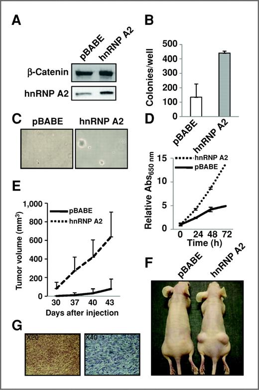 Figure 3. hnRNP A2/B1 can transform NIH 3T3 cells in vitro and in vivo. A, NIH 3T3 cells transduced with empty vector (pBABE) or hnRNP A2/B1 (A2) were analyzed by Western blotting for hnRNP A2/B1 protein expression and β-catenin was used as a loading control. B, quantification of colony formation in soft agar of cells described in A. Error bars represent SD (n = 2). C, representative fields of colonies in soft agar described in B. D, proliferation of cells described in A was examined by methylene blue staining. Error bars indicate the SD (n = 6). E, cells described in A were injected (106 cells/site) subcutaneously near both rear flanks of nude/nude mice, and tumor volume was measured biweekly. Error bars indicate SD (n = 8). F, representative mice described in E are shown. G, light micrographs of formalin-fixed, paraffin-embedded tissue sections from tumors derived from NIH 3T3 cells overexpressing hnRNP A2/B1, stained with hematoxylin and eosin.