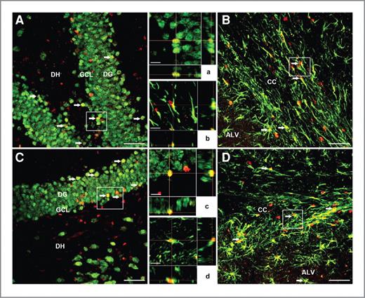 Figure 5. Differentiation of transplanted hNSCs in the irradiated hippocampus. At 1 month postgrafting (A, B and a, b), BrdUrd-positive (red) hNSCs differentiated into NeuN-positive (green) mature neurons (A and a) and GFAP-positive (green) astrocytes (B and b) as visualized by dual labeling of neuron- or astrocyte-specific markers. Similar phenotypes were observed at 4 months postgrafting (C, D and c, d), where BrdUrd-positive (red) engrafted cells were colabeled with markers of mature neurons (NeuN, green; C and c), and astrocytes (GFAP, green; D and d). Arrows indicate dual labeled grafted cells, and boxes represent regions magnified for orthogonal Z-stacks (in A–D). Orthogonal reconstructions of BrdUrd+/NeuN+ colabeled cells (a and c) and BrdUrd+/GFAP+ colabeled cells (b and d) are shown at each postgrafting time point. GCL, granule cell layer; ALV, alves of hippocampus; DG, dentate gyrus; DH, dentate hilus. Scale bars: A–D, 50 μm; a–d, 10 μm.