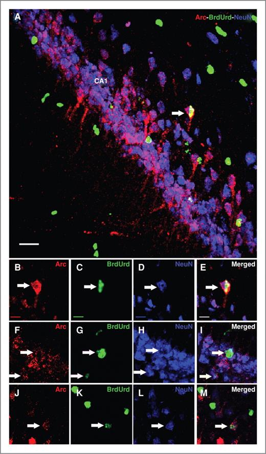 Figure 7. HNSC graft–derived cells express behaviorally induced Arc in the irradiated hippocampus. Irradiated animals engrafted with hNSCs and subjected to a hippocampal-dependent novelty exploration task at 1 month postgrafting were rapidly processed for the isolation and analysis of brain tissues. Engrafted hNSCs (BrdUrd+ cells, green; A, C, G, and K) differentiated into NeuN-positive mature neurons (blue; A, D, H, and L) and expressed Arc (red; A, B, F, and J) as visualized by the triple labeling of neuron- and Arc-specific markers (A, E, I, and M). Arrows indicate triple-labeled cells. Scale bars: A, 50 μm; B–M, 10 μm.