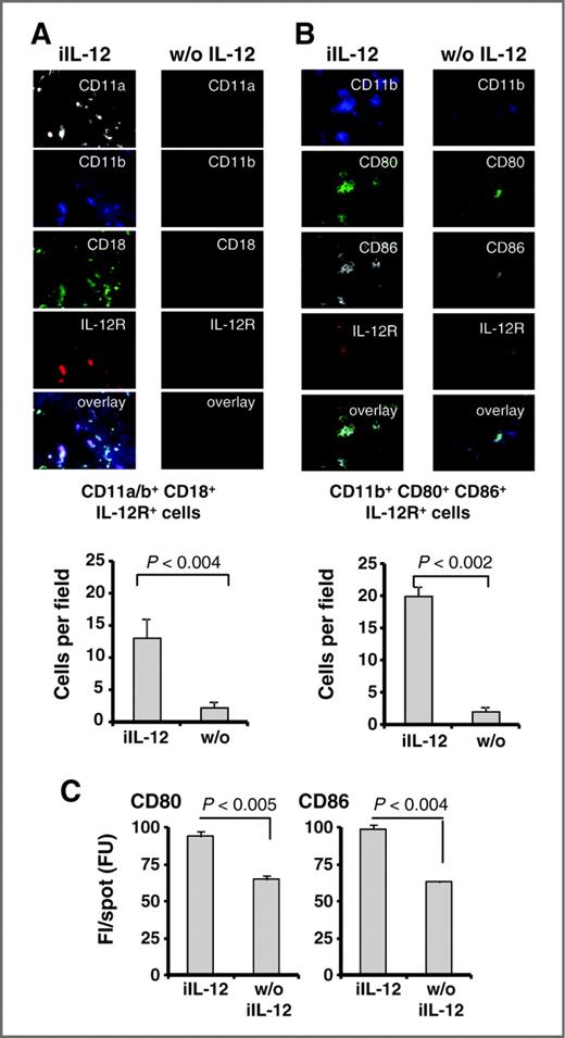 Figure 4. Activated macrophages accumulate in tumors upon iIL-12 release by engineered T cells. Tumors treated with anti-CEA CAR T cells with or without iIL-12 were analyzed at day 5 for the presence of macrophages by staining for CD11a, CD11b, CD18, and IL-12Rβ1 receptor (A) and CD11b, CD80, CD86, and IL-12Rβ1 (B). The numbers of macrophages per optical microscope field were determined. C, the levels of CD80 and CD86 expression were determined by recording the fluorescence intensity (FI) per spot using stainings shown in B. Statistical analyses were carried out by the Student t test.