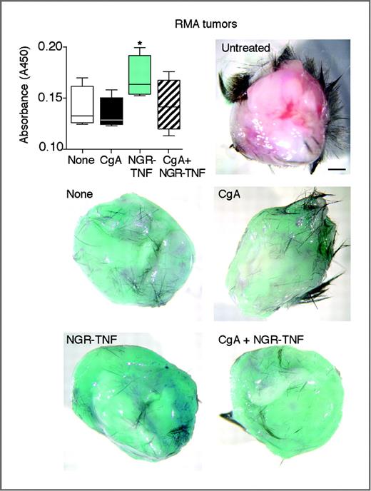 Figure 5. CgA inhibits the NGR-TNF−induced penetration of Patent Blue VF in tumor. RMA tumor–bearing mice (diameter, 0.5–1 cm) were treated with CgA (1 μg), NGR-TNF (0.1 ng), and, 2 hours later, with Patent Blue VF (12.5 mg/mL, 0.1 mL, i.v.). After 5 minutes, mice were killed and perfused. Tumors were excised, homogenized, and centrifuged. The supernatants were mixed with trichloroacetic acid [10% (v/v), final concentration] and cleared by centrifugation. The absorbance at 405 nm was then measured using a spectrophotometer (n = 4 mice per group, box-plots with median, interquartile, and min/max values). *, P < 0.05 by t test (2-tailed).