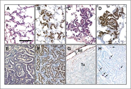 Figure 3. Adenomas develop in the lungs of doxycycline (DOX)-treated CN1 mice. A–D, sections from CN1 mice maintained on DOX treatment for 8 months. A, H&E-stained section showing organized growth along the alveolar walls. B, immunohistochemical staining for Notch1 showing that N1ICD+ cells grow along the alveolar walls instead of in cell clusters. C, H&E-stained section showing an early adenoma. D, immunohistochemical staining of an early adenoma for Notch1. E–H, adenomas from CN1 mice maintained on DOX for more than 1 year. E, H&E-stained section that shows the papillary patterning of a CN1 adenoma. Adenomas were TTF-1+ (F), but CCSP− (BE, bronchiolar epithelium; Tu, tumor; G) with rare SPC+ cells (arrows) clearly discernable in immunohistochemically stained sections (H). Bar in A, 0.1 mm; A–H, same magnification.
