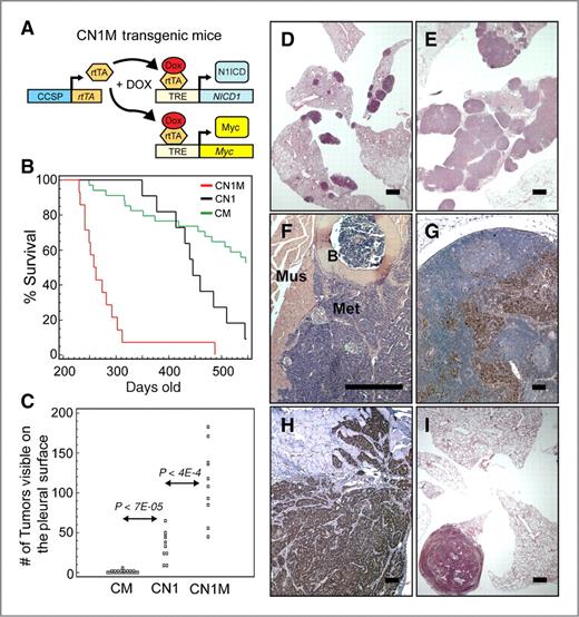 Figure 5. N1ICD and Myc coexpression cooperates to induce lung adenocarcinoma. A, schematic of transgenes used for coincident overexpression of N1ICD and Myc. B, Kaplan–Meier plot of doxycycline (DOX)-treated CM (n = 34), CN1 (n = 11), and CN1M (n = 14) mice monitored for 18 months (P < 1E-4 by log-rank test for CN1M vs. either CM or CN1). C, quantification of tumors visible on the pleural surface of transgenic mice (P values calculated using Student's t test). The cumulative numbers of tumors up until 18 months is displayed. D–F, H&E-stained sections from transgenic mice maintained on a DOX diet. D, lungs from a CN1 mouse with multiple adenomas. E, lungs from a CN1M mouse that developed multiple large adenocarcinomas. F, metastatic lesion growing on the wall of the thoracic cavity (B, bone; Mus, muscle; Met, metastases). G and H, immunohistochemical staining of metastases for the lung epithelial marker TTF-1. G, TTF-1+ cells (brown) in an enlarged lymph node. H, TTF-1+ cells that have invaded intercostal muscle of the ribcage. I, H&E-stained lung section from a DOX-fed CM mouse with a large adenocarcinoma. Bars in D, E, I, 1 mm; F–H, 0.1 mm.