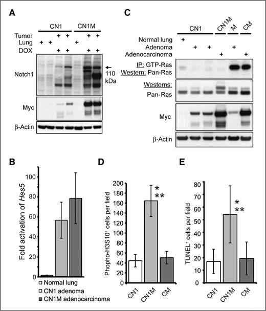 Figure 6. Increased tumor cell cycling correlates with enhanced tumorigenesis in CN1M mice. A, Western blot analysis of Notch1 and Myc expression in lungs and tumors from CN1 and CN1M transgenic mice. B, TaqMan analysis comparing Hes5 expression in the lungs of CN1 mice not treated with doxycycline (DOX) and in tumors from DOX-treated CN1 and CN1M mice. C, RAS activity assay on protein lysates from normal lung and tumors from CN1 and CN1M transgenic mice. Tumor lysates from a spontaneous adenoma arising in a mouse carrying only the Myc transgene (no rtTA transgene present) and an adenocarcinoma from a CM mouse, both known to harbor an activating mutation in Kras, served as positive controls for RAS activity and RAS and Myc expression. β-Actin served as a loading control. D, quantification of phospho-H3S10+ cells in tumors from DOX-treated CN1 (n = 12), CN1M (n = 13), and CM (n = 7) mice (*, P < 8.2E-10 compared with CN1 adenomas; **, P < 1.7E-09 compared with CM adenocarcinomas; Student's t test). E, quantification of TUNEL+ cells in tumors from DOX-treated CN1 (n = 16), CN1M (n = 15), and CM (n = 13) mice (*, P < 1.2E-5 compared with CN1 adenomas; **, P < 4.4E-05 compared with CM adenocarcinomas; Student's t test).
