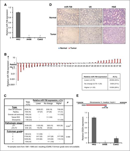Figure 1. miR-708 expression is attenuated in renal cancer. A, quantitative RT-PCR analysis of relative miR-708 expression levels in human renal cancer (A498 and Caki2) and normal immortalized renal cell line (HK2). Data were normalized to RNU48 control and are represented as mean ± SEM. B, relative miR-708 expression levels in RCC clinical specimens and patient-matched normal tissues as assessed by real-time PCR. The table summarizes the relative miR-708 expression levels in these specimens. C, correlation of miR-708 expression with subtype, clinicopathologic stage, and Fuhrman grade of renal cancer tissues used for miR-708 expression analysis in (B). D, in situ hybridization analysis of miR-708 expression in human renal cancer tissues and matched cancer adjacent normal tissues showing attenuated miR-708 expression in RCC tumor (bottom) compared with matched normal adjacent tissue (top). U6 staining confirmed the preservation of intact small RNAs in the same tissues (middle); H&E stained sections allowed the identification of tumors (right). E, schematic representation of the genomic location of the miR-708 locus in humans at chromosomal position 11q14.1 in ODZ4 gene intron. Relative expression levels of ODZ4 in RCC cell lines as assessed by real-time PCR. *, P < 0.05.