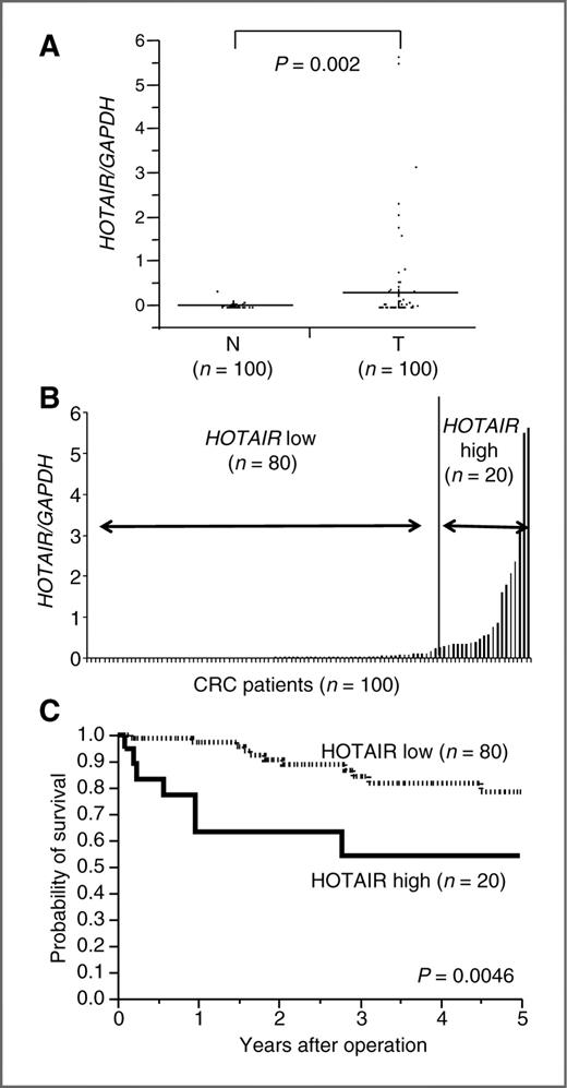 Figure 1. A, HOTAIR expression levels assessed by quantitative real-time PCR in cancerous (T) and noncancerous tissues (N) from 100 CRC samples. HOTAIR levels were normalized to GAPDH. HOTAIR levels in T were significantly lower than those in N (P = 0.002). Horizontal lines, mean value of each sample. B, quantitative real-time PCR analysis of HOTAIR in 100 CRC tissues and the classification based on HOTAIR level (HOTAIR/GAPDH = 0.0273). Vertical line, borderline of HOTAIR high (n = 20) or low (n = 80). C, Kaplan–Meier overall survival curves according to HOTAIR level. The overall survival of the high HOTAIR expression group (n = 20) was significantly higher than that of the low expression group (n = 80; log-rank test; P = 0.0046). GAPDH, glyceraldehyde-3-phosphate dehydrogenase.