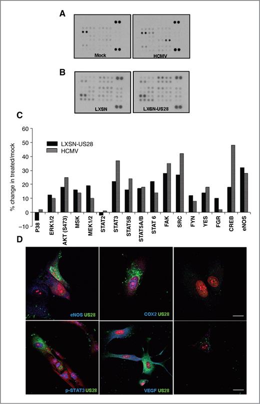 Figure 3. US28 induces activation of cellular kinases involved in glioma pathogenesis. A and B, HCMV (Towne; MOI = 1) and mock-treated NPCs (A) and glioma cells (B) were profiled with a phosphor-kinase human antibody array. C, densitometry measurements were done per the manufacturer's instructions. Percentage of change in phosphorylation levels between HCMV/US28-treated and control cells is shown. One (of 2) representative experiment is shown. D, double immunofluorescence for US28 and the indicated proteins in NPCs transduced with LXSN-US28 for 48 hours. Right, IgG staining controls. Nuclei were counterstained with propidium iodide. Bar, 50 μm.