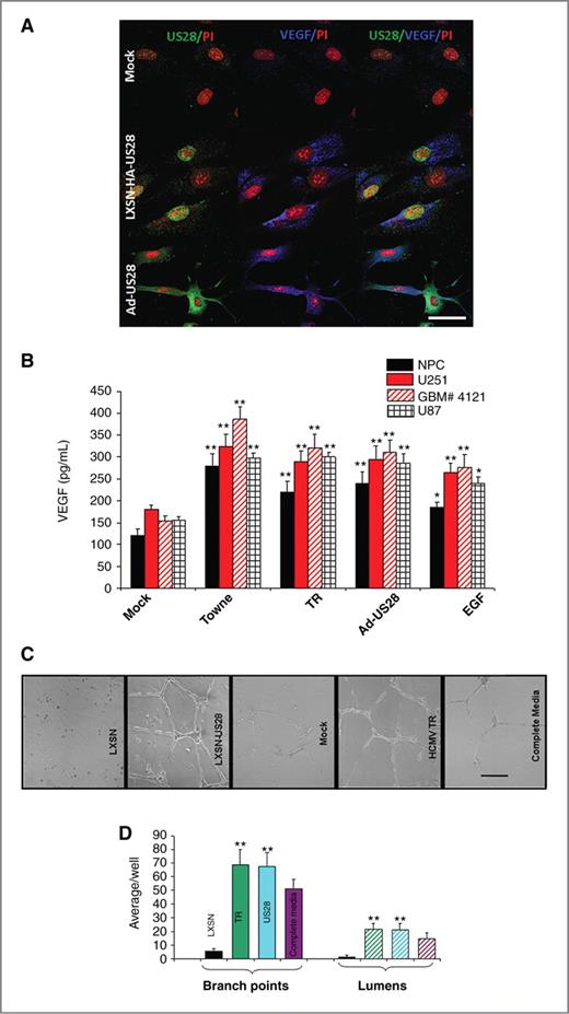 Figure 4. US28 promotes glioma angiogenesis. A, NPCs transduced with either LXSN-HA-US28 or Ad-US28 and control LXSN/mock-treated cells were processed for immunofluorescence. Right, NPCs that express US28 (green) secrete VEGF (blue), as shown by colocalization of the 2 markers. Nuclei are stained with propidium iodide. Bar, 100 μm. B, NPC, U251, U87, and a primary GBM line (4121) were treated with HCMV (Towne and TR; MOI = 1), transduced with Ad-US28, or treated with EGF (50 ng/mL) in serum-free media. Supernatants were used in an ELISA for VEGF. Samples were assayed in quadruplicate, and the experiment was repeated twice. Comparisons between treated and mock within the same cell line were analyzed by ANOVA. *, P = 0.02; **, P < 0.002. C, NPC-derived supernatants were tested in HUVEC tube formation assays. Complete endothelial cell growth media was used as a positive control. Representative photomicrographs are shown. Each condition was assayed in 6 wells of a 24-well plate, and the experiment was repeated twice. Bar, 100 μm. D, average numbers of branch points and endothelial cell lumens are shown from 1 representative experiment. Comparisons were analyzed by ANOVA. **, P < 0.02 in all cases.