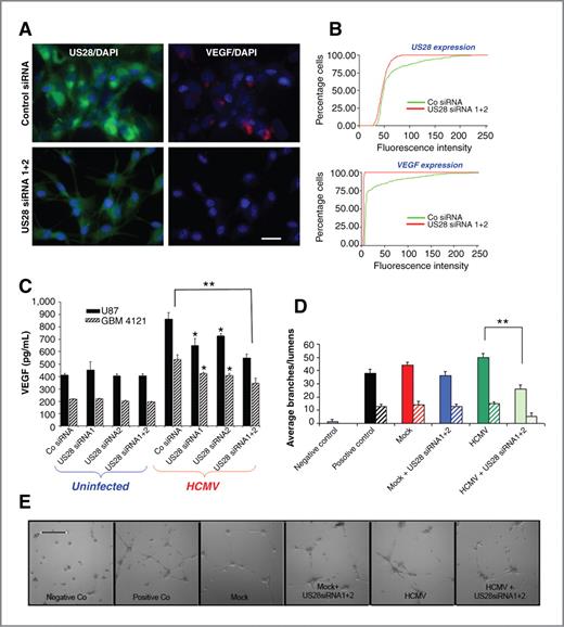 Figure 5. US28 knockdown in HCMV-infected glioma cells inhibits VEGF secretion and subsequent angiogenesis. A, immunofluorescence was used for detection of US28 (green) and VEGF (red) in U87 cells persistently infected with HCMV treated either with control siRNA (top) or siRNA1+2 targeting US28. Nuclei were counterstained with DAPI. Bar, 50 μm. B, cumulative distribution of mean pixel intensity per cell obtained from immunofluorescence detection of US28 and VEGF in U87 cells treated with either targeting (siRNA1+2) or control siRNAs. The Kolmogorov–Smirnov test was used to determine significance of differences in the fluorescence intensity measured in more than 100 cells per condition, P = 0.0001. C, VEGF levels were measured by ELISA in U87 glioma cells and primary 4121 GBM cells uninfected or HCMV-infected in the presence of either control or US28 targeting siRNA1, siRNA2, or siRNA1+2. Differences were significant. *, P = 0.05; **, P = 0.002, the Student t test. D, quantification of HUVEC branches and lumens formed in each of the indicated conditions. **, P < 0.02, ANOVA. E, representative photomicrographs of HUVEC tube formation assay in the presence of various types of conditioned media, as indicated. Bar, 100 μm. HUVEC tube formation assays were repeated 3 times, each condition was run in quadruplicate.