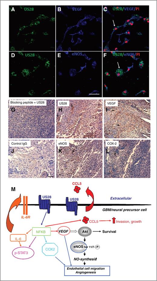 Figure 6. HCMV US28 colocalizes with markers of invasiveness and angiogenesis in situ. A–F, primary glioblastoma-derived cells were processed for immunofluorescence with antibodies against US28 (A and D), VEGF (B), and e-NOS (E). C and F, merged photomicrographs of colocalization of US28 and the 2 markers of angiogenesis. Nuclei are counterstained with propidium iodide. Bar, 100 μm. G–L, consecutive paraffin sections (5 μm apart) from a glioblastoma specimen were stained for US28, VEGF, e-NOS, and COX2 and developed with horseradish peroxidase–3,3′-diaminobenzidine. Arrows indicate cells positive for several markers in the same area. Counterstaining, hematoxylin. Bar, 50 μm. M, summary of the autocrine and paracrine signaling pathways through which US28 promotes GBM growth, invasion, and angiogenesis.