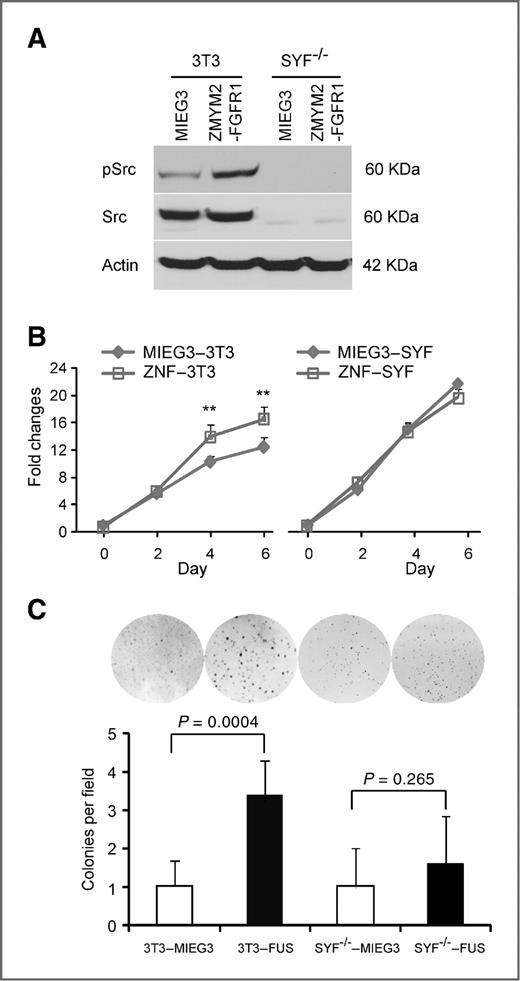 Figure 5. Knockdown of Src impairs transformation of 3T3 cells by ZMYM2-FGFR1. A, Src-Yes-Fyn null mouse embryo fibroblasts (SYF−/−) and NIH3T3 (3T3) cells were infected with ZMYM2–FGFR1 or MIEG3 retroviral constructs. Stably infected pools were sorted for GFP-positive cells and then analyzed by Western blotting with anti–phospho-Src antibodies. The phospho-Src levels are increased in ZMYM2–FGFR1–transformed 3T3 cells. In contrast, total and phospho-Src proteins are not detectable in triple knockout SYF−/− cells transduced with ZMYM2–FGFR1. B, cell proliferation assays show that ZMYM2–FGFR1 expression increases cell proliferation in NIH3T3, but not in SYF−/− cells. **, P < 0.01. C, transduction with ZMYM2–FGFR1 significantly promotes anchorage-independent growth of 3T3 cells (3T3-FUS), but not SYF−/− cells (SYF−/−-FUS).