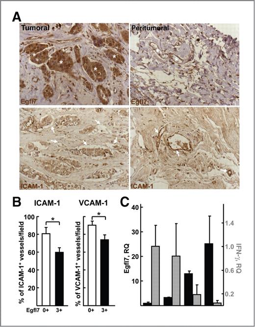 Figure 7. High expression of Egfl7 correlates with low VCAM-1, ICAM-1, and IFN-γ in human tumors. A, expression of Egfl7 (top, brown) and ICAM-1 (bottom, brown) was analyzed by immunohistochemistry in a human breast ductal invasive carcinoma (noted SBR II, RE+, RP+, and HER2 0). The tumor tissue, which expresses large amounts of Egfl7 within tumor cells (top left, *), shows low levels of ICAM-1 in adjacent blood vessels (bottom left, arrows). The peritumoral region, which expresses low levels of Egfl7, mostly in blood vessels (top right, *), shows strong expression of ICAM-1 in blood vessel endothelium (bottom right, arrows). B, expression of ICAM-1 and VCAM-1 in blood vessels was quantified as the mean percentage of positive vessels in 25 independent 0.15-mm2 fields in tumors expressing low (0+, n = 5) and high (3+, n = 5) levels of Egfl7. *, P < 0.05. C, human breast carcinomas (n = 12 per group) were analyzed for expression of Egfl7 (black bars) and IFN-γ (gray bars) by quantitative RT-PCR. For each sample, data were normalized to the β2-microglobulin expression levels. Data are expressed at 2(−ΔΔCt), taking the lowest average value as reference for each gene. RQ, relative quantities.