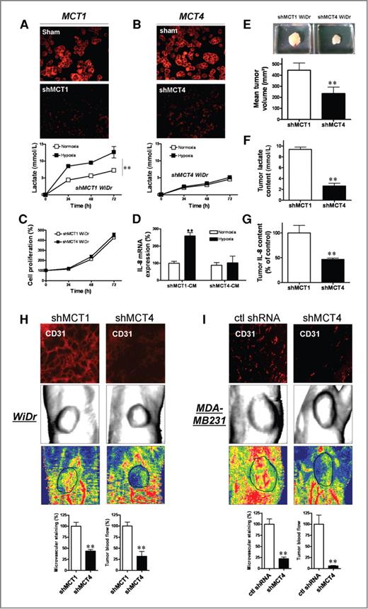 Figure 5. Lactate efflux through tumor cell MCT4 stimulates IL-8 expression in endothelial cells and promotes tumor vascular development in vivo. WiDr colorectal cancer cells were sham or stably transfected with a MCT1- or MCT4-targeting shRNA. Representative photographs of (A) MCT1 and (B) MCT4 immunostaining. Graphs represent the time course of lactate release from shMCT1 WiDr cells (A, bottom) and shMCT4 WiDr cells (B, bottom) cultured under normoxic (open symbols) or 1% O2-hypoxia (black symbols; *, P < 0.01, n = 4). C, graph represents the in vitro proliferation rate of shMCT1- or shMCT4 WiDr cells (n = 3). D, bar graph represents IL-8 mRNA expression determined by qPCR from endothelial cells cultured for 6 hours in the presence of CM of shMCT1- or shMCT4 WiDr cells maintained (for 72 hours) under normoxia (open bars) or hypoxia (black bars; *, P < 0.01, n = 3). E, representative photographs of tumors removed from mice injected (14 days before) with Matrigel plug containing 5 × 104 endothelial cells mixed either with 5 × 105 shMCT1 WiDr cells or 5 × 105 shMCT4 WiDr cells. Bar graph (E, bottom) represents the mean tumor volume of corresponding tumors (n = 5; P < 0.01). Bar graphs represent the intratumor lactate (F) and IL-8 (G) concentrations in the tumors described in E. Representative photographs of CD31 immunostaining, laser Doppler imaging (including reconstituted tumor photograph) of WiDr (H) and MDA-MB231 (I) tumors. Quantifications of corresponding microvascular density and perfusion are presented in bar graphs (H and I, bottom).