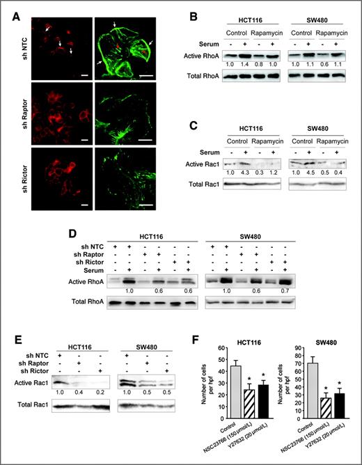 mTORC1 and mTORC2 Regulate EMT, Motility, and Metastasis of Colorectal ...