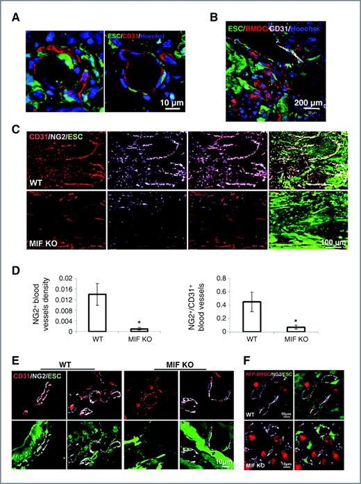 Figure 2. The origin of endothelial cells and pericytes during teratoma development in WT mice at 2 weeks after ESC injection. A, immunofluorescence staining for CD31 (red) with confocal microscope. B, representative photographs of immunostaining for CD31 (purple) in teratoma sections from WT mice after RFP+ BM cell transplantation. C, immunostaining of sections from WT (top) and MIF KO mice (bottom) at 2 weeks after ESC injection showing double staining for NG2 (purple) and CD31 (red). D, quantification of NG2+ pericyte density (left), and normalized pericyte density of vessels (right), density of pericytes divided by the density of CD31+ vessels (n = 10; *, P < 0.05, 2-sided Wilcoxon test). Data are represented as mean ± SEM. E, representative confocal microscopic images of CD31/NG2 double-stained vessels within teratomas of WT (left) and MIF KO mice (right) at 2 weeks after ESC injection. F, representative confocal microscopic images of NG2+ pericytes (purple) and RFP+ BM-derived cells (red) within teratomas of WT (top) and MIF KO mice (bottom) that received RFP+ BM transplantation.