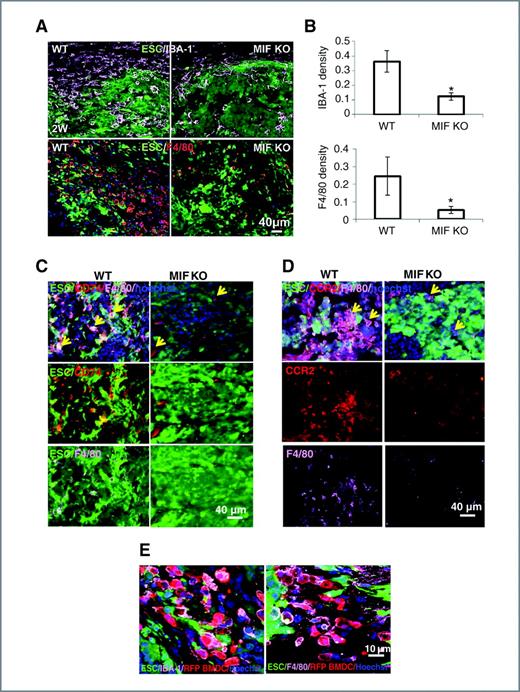 Figure 3. ESCs recruit BMDMs. A, macrophage recruitment during teratoma progression. Macrophages in the sections of spinal cord at 2 weeks after ESC transplantation in WT (left) and MIF KO mice (right) were detected by antibodies to IBA-1 (top) and F4/80 (bottom). B, quantification of IBA-1+ macrophages (top) and F4/80+ (bottom) at 2 weeks after ESC transplantation (n = 10; *, P < 0.05, 2-sided Wilcoxon test). Data are represented as mean ± SEM. C, representative images of immunostaining of sections at 2 weeks after ESC injection showing double staining (arrows) for CD74 (red) and F4/80 (purple) in WT (left) and MIF KO mice (right). D, representative images of immunostaining of sections at 2 weeks after ESC injection showing double staining (arrows) for CCR2 (red) and F4/80 (purple) in WT (left) and MIF KO mice (right). E, BMDM recruitment during teratoma progression. Representative confocal microscopic images of sections of spinal cord from RFP-BM reconstituted mice at 2 weeks after injection were stained with IBA-1 (purple, left) and F4/80 (purple, right), respectively.