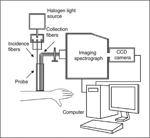 Figure 1. A schematic of the experimental OIDRS system.