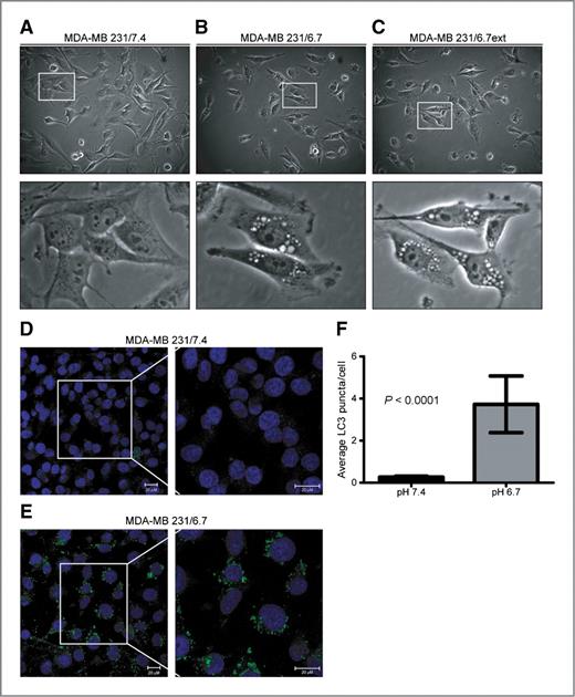 Figure 2. Morphologic analysis of MDA-MB-231 cells cultured at pH 7.4 (A) or pH 6.7 for 48 hours (B) or for approximately 3 months (C). Subcellular localization of LC3 in MDA-MB-231 cells cultured at pH 7.4 (D) or pH 6.7 (E) for 48 hours. Images were captured by confocal microscopy and are representative of 3 independent experiments. Size bars, 20 μmol/L. F, the number of LC3 puncta was quantified using Definiens Developer XD. Data represent the average LC3 puncta per cell ± SD.