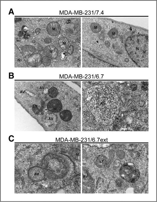 Figure 4. Transmission electron microscopy of double-membrane autophagic vacuoles in MDA-MB-231 cells cultured at pH 7.4 (A), pH 6.7 for 48 hours (B), or at low pH (6.7) for approximately 3 months (C). Autophagic vacuoles were detectable in MDA-MB-231 cells transiently or chronically exposed to pH 6.7. AV, autophagic vacuole; LY, lysosome; M, mitochondria; N, nucleus.