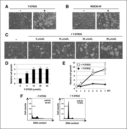 Figure 1. ROCK inhibitors improve sphere-forming efficiency from primary colon cancer cells. A and B, bright-phase images of spheroids (#6) in the presence or absence of 20 μmol/L Y-27632 (A) or 5 μmol/L ROCKi-IV (B). C, bright-phase images of spheroids (#6) in the presence of the indicated concentrations of Y-27632. D, dose-dependent curves of the cell growth of spheroid cells (#6) by Y-27632 on day 3. Cell growth was quantified by measuring cellular ATP. E, time course of spheroid cell growth (#6) in the presence or absence of 20 μmol/L Y-27632. F, suppression of cell death of spheroid cells (#6) by Y-27632. Spheroid cells were stained with propidium iodide, and a fraction of cells with sub-G1 DNA content was measured by flow cytometry analysis.