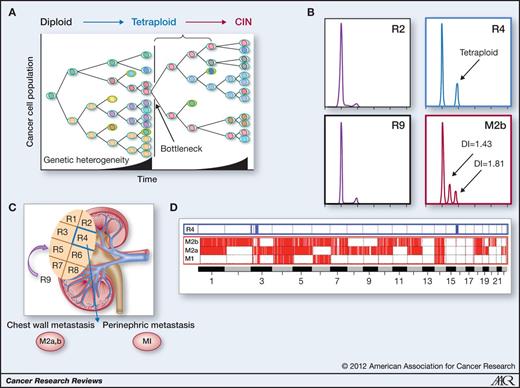 Figure 2. Evolutionary bottlenecking and restriction of diversity between primary and metastases. A, transient restriction of diversity through an evolutionary bottlenecking process, for example, during clonal selection through therapy or during metastatic progression may lead to the requirement for alternative mechanisms to generate ITH. One such mechanism can be generated through structural and whole CIN. Tetraploidy is thought to be a precursor of CIN. B and C, multiregion analysis of a primary renal-cell carcinoma and its metastatic sites revealed that the metastatic lesions were most similar to region 4 of the primary. Ploidy analysis revealed that the primary regions were all diploid with the exception of region 4, which was tetraploid. Metastatic sites were subtetraploid. D, allelic imbalance analysis revealed substantial heterogeneity in chromosome structure between 2 biopsies of the same metastatic site (M2a and M2b). Taken together with ploidy analysis, these data indicate the possible emergence of CIN at metastatic sites. Longitudinal studies will reveal to what extent metastatic sites represent outgrowth of multiple heterogeneous subclones from the primary tumor and genetic events that may be permissive for metastatic outgrowth during the bottlenecking process. Adapted from Gerlinger et al. (14, 18).