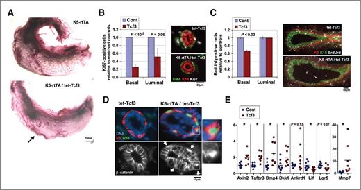 Figure 7. Tcf3 overexpression impairs duct development. A, whole mount-stained mammary glands of a control K5-rtTA mouse and a K5-rtTA/tet-Tcf3 mouse following Tcf3 induction from 3 to 9 weeks of age. Arrow indicates growth end-point. B, Ki67-positive cell numbers in the duct layers of Tcf3-induced (1 week) mice (n = 7) normalized to estrus-matched control mice (set as 1, n = 4). Right, representative images. SMA, smooth muscle actin. Endogenous Tcf3 is not detected at this exposure. C, numbers of BrdUrd-positive cells in TEBs of same mice (9 TEBs in 4 mice), normalized to controls (9 TEBs in 5 mice). Right: composite images of stained TEBs. D, costaining of β-catenin (white) and Tcf3 (green) in ducts of control or Tcf3-induced (1 week) mice. Arrows, nuclear β-catenin; insets, selected individual cells. E, expression levels of the indicated genes in the mammary epithelia of control and Tcf3-induced (1 week) mice. Circles, individual mice, n = 8 in each group; bars, mean. *, P < 0.05.