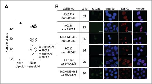 Figure 4. Genomic and functional assessments of BRCAness in basal-like cell lines. A, cell lines with basal-like phenotype display discriminative features of BRCAness similar to primary BLCs. Known status for BRCA1 and BRCA2 are indicated for germline mutations (BRCA1 and BRCA2) and methylation of BRCA1 promoter (meBRCA1). Cell lines without evidence of BRCA1/2 inactivation are described as wtBRCA1/2. B, RAD51 foci formation 8 hours after 10 Gy irradiation illustrates active HR in non-BRCA1 cell lines and, conversely, deficient HR in BRCA1 or BRCA2 mutated cell lines. 53BP1 foci in the same experiment are shown as a control for DNA damage response. Scale bars, 20 μm. Number of LST is indicated as well as BRCA1/2 status. mut, mutated; me, methylation of the promoter; wt, wild type.