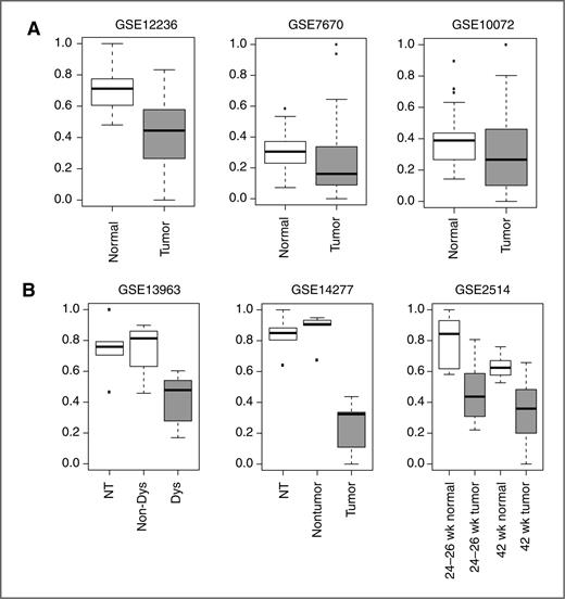 Figure 4. SIRT1 pathway activation in lung tumor tissue. A, human datasets; B, murine datasets. A, left, lung adenocarcinoma tumor tissue (n = 20) and paired adjacent normal lung tissue (n = 20) from dataset GSE12236. SIRT1 pathway activation was significantly decreased in lung tumor tissue (P < 0.001). Middle, lung adenocarcinoma tumor tissue (n = 28) and paired adjacent normal lung tissue (n = 28) from dataset GSE7670. SIRT1 pathway activation was significantly decreased in lung tumor tissue (P = 0.033). Right, lung adenocarcinoma tumor tissue (n = 33) and paired adjacent normal lung tissue (n = 33) from dataset GSE10072; samples without paired normal lung tissue were excluded. SIRT1 pathway activation was decreased in lung tumor tissue (P = 0.062). B, left, laser microdissection pressure catapulting (LMCP) dysplastic lung epithelial cells from SP-C/c-raf-1 transgenic mice (Dys, n = 5), LMCP unaltered lung epithelial cells from SP-C/c-raf-1 transgenic mice (Non-Dys, n = 4), and LMCP lung epithelial cells from nontransgenic mice (NT, n = 5) from dataset GSE13963. SIRT1 pathway activation was decreased in dysplastic cells versus nondysplastic cells from transgenic mice (P = 0.085). Middle, LMCP lung tumor epithelial cells from SP-C/c-raf transgenic mice (tumor, n = 5), LMCP unaltered lung epithelial cells from SP-C/c-raf transgenic mice (nontumor, n = 5), and LMCP lung epithelial cells from nontransgenic mice (NT, n = 5) from dataset GSE14277. SIRT1 pathway activation was decreased in tumor cells versus nontumor cells from transgenic mice (P = 0.008). Right, lung tissue from A/J mouse-urethane model of lung adenocarcinoma harvested 24 to 26 weeks after treatment (adjacent normal lung tissue, n = 8 and tumor lung tissue, n = 12) and after 42 weeks of treatment (adjacent normal lung tissue, n = 7 and tumor lung tissue, n = 17) from dataset GSE2514. SIRT1 pathway activation was decreased in tumor tissue at both time points (P = 0.002 and 0.001, respectively).
