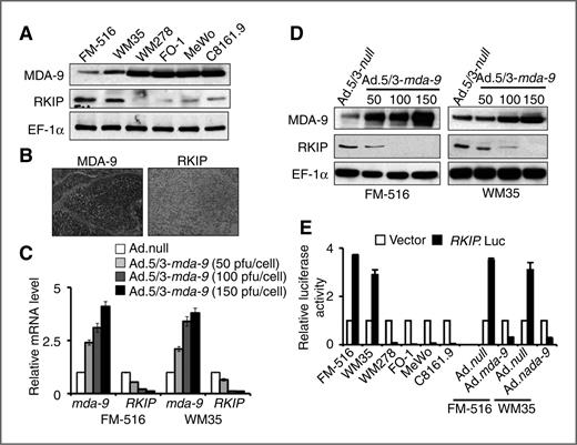 Figure 1. Expression of RKIP inversely correlates with MDA-9 expression. A, the protein expression of RKIP in the indicated cells was determined. B, photomicrograph of MDA-9 and RKIP expression in a tumor section from the same metastatic melanoma patient. C and D, FM-516 and WM35 cells were infected with either Ad.5/3-null or Ad.5/3-mda-9 and after 48 hours, serum-starved cells were plated on fibronectin and the expression of RKIP and MDA-9 was determined both at mRNA and protein levels. E, cells were transfected with a RKIP promoter luciferease reporter plasmid (RKIP.Luc) and 48 hours after transfection, cells were harvested for luciferase assays. FM-516 and WM35 cells were infected with either Ad.5/3-null or Ad.5/3-mda-9 at multiplicity of infection of 100 pfu/cells for 24 hours and then transfected with an RKIP promoter luciferase reporter plasmid. Luciferase assays were conducted at 48 hours posttransfection.