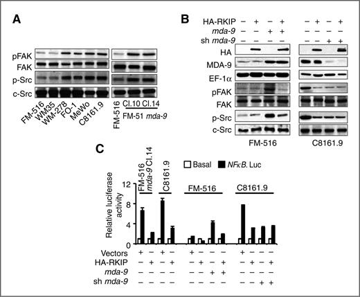 Figure 4. Forced expression of RKIP overrides MDA-9–mediated changes in specific signaling pathways. A, cell lysates were analyzed for the indicated proteins by Western blotting. B, the indicated cell lines were transiently cotransfected with indicated plasmids and lysates were subjected to Western blot analysis. C, cells were transfected with the indicated plasmids and luciferase assays were conducted to determine NF-κB promoter activity. The data represent the mean ± SD of 3 independent experiments.