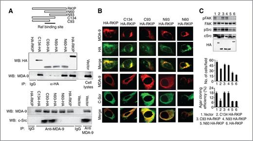 Figure 5. MDA-9 interacts with HA-RKIP. A, top, schematic representation of the domain structures of different deletion mutants of RKIP. Bottom, cells were transfected with different deletion constructs, immunoprecipitated (IP), and immunoblotted (WB) with the indicated antibody. B, fluorescent confocal microscopy of cells (C8161.9) transfected with HA-RKIP or specific HA-RKIP deletion mutants. C, the indicated constructs were transfected into C8161.9 cells and Western blotting (top) detected expression of specific proteins. Different deletion constructs were transfected into C8161.9 cells and after 48 hours were analyzed using invasion (middle) and anchorage-independent growth assays (bottom). IgG, immunoglobulin G.