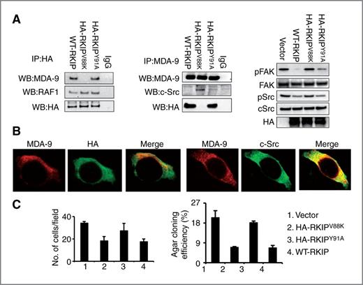 Figure 6. MDA-9 interacts with RKIP through internal PDZ domains. A, left panel, wild type or mutant RKIP (RKIPV88k and RKIPY91A) were transfected into C8161.9 cells and 48 hours later, cell lysates were immunprecipitated with anti-HA (left) or anti-MDA-9 (middle) and immunoblotting was conducted with specific antibody as indicated. In the right panel, cell lysates were analyzed for different protein levels as shown in the figure. B, representative fluorescent confocal micrographs show the interaction of MDA-9 and mutant RKIP (HA-RKIPV88K) following transfection into C8161.9 cells. C, wild type or different mutants of RKIP were transfected into C8161.9 cells and after 48 hours were analyzed using invasion (left) and anchorage-independent growth assays (right).