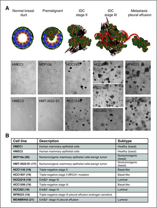 Figure 1. A cellular model of breast cancer progression. A, a panel of 11 cell lines, which were isolated from human tumors with a defined stage, and from normal or premalignant tissues. Colony formation assays shows increased tumorigenic potential in the higher tumor stages. B, description of breast cancer cell lines, including their stage and subtype. References are given in parentheses. IDC, invasive ductal carcinomas.