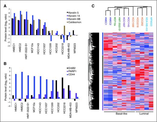 Figure 2. Global proteomics results. A, proteomics data identify downregulation of known myoepithelial markers in the transformed cells. B, quantification of known breast cancer markers. C, hierarchical clustering segregates the cell lines to basal and luminal subtypes, and in a second level, segregates according to the stage. Proteins are segregated to 3 clusters. The names of the cells lines are color-coded according to their stage.