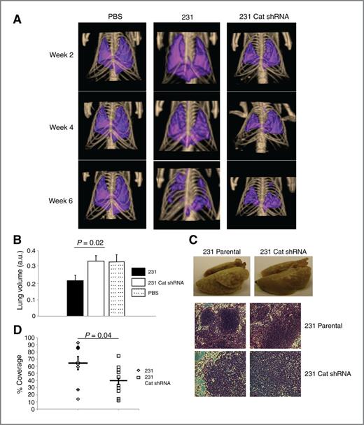 Figure 6. Elimination of antioxidant enzyme expression reduces tumor formation in vivo. A, PBS, 231, or 231 catalase shRNA cells were injected (2 × 106 cells per injection) via tail vein into female nude mice. Representative CT images of lung volume were obtained at 2, 4, and 6 weeks after injection. B, quantitation of lung volume from CT scans at week 4 of 231, 231 catalase shRNA, and PBS injected mice (n = 6 for PBS, n = 9 for 231, and n = 10 for 231 catalase shRNA). C, mice were sacrificed 6 weeks after injection and lungs were harvested and fixed in Bouin's solution. In addition, lungs were sectioned and stained with hemotoxylin and eosin. Representative images of lungs from 231 and 231 catalase shRNA are shown. D, quantitation of lung tumor burden was conducted in mice that were injected with either 231 or 231 catalase shRNA cells (n = 9 for 231 and n = 10 for 231 catalase shRNA). Using ImageJ, the percentage of lung that was covered with tumor was quantified and plotted. All error bars represent SEM, and P values were determined using a 2-tailed t test.