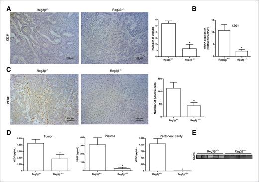Reg3β Deficiency Impairs Pancreatic Tumor Growth by Skewing Macrophage ...