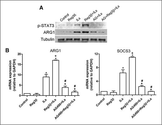 Reg3β Deficiency Impairs Pancreatic Tumor Growth by Skewing Macrophage ...