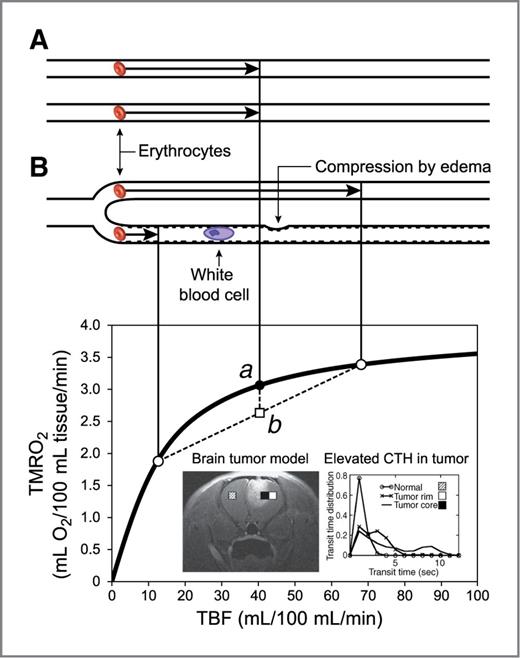 Figure 1. The flow–diffusion relation for oxygen. The classical flow–diffusion equation determines the maximum amount of oxygen that can diffuse from a single capillary into tissue for a given flow velocity. In the graph, flow velocity and oxygen extraction for a single capillary are replaced by tumor blood flow per volume unit (TBF) and net oxygen extraction per tissue volume (TMRO2max) on the x- and y-axes, respectively. This generalization is only true if all capillary flow velocities are identical. This is most easily understood by observing that net tissue oxygen availability is lower in case B (half of the capillaries have low flows, the other half high flows) than in case A (equal flows), although TBF is identical in the two cases: In the heterogeneous case (B), the net tissue oxygen availability is the average of the oxygen availabilities for the two flows, labeled b in the plot. Owing to the concave shape of the TBF–TMRO2max relation, which holds for capillaries with identical flows, b is always smaller than a, the oxygen availability for homogenous capillary flows. Sources of poor microcirculatory control across the tumor microvasculature are discussed in detail in ref. 18. Note that several properties of individual tumor capillaries, blood rheology, and tumor microenvironment can hinder a uniform distribution of erythrocytes. These include low-grade inflammation, which increases the adhesion among capillary endothelium and blood cells (indicated by the rugged inner surface of the lower capillary), slow-passing white blood cells, capillary walls with abnormal surface properties and diameters, and capillary compression because of increased interstitial pressure in the tumor. Upstream vasodilation may in fact amplify the redistribution losses shown above, as erythrocytes are forced through other branches at very high speeds, with negligible net oxygenation gains. The image (inset) and the accompanying graph in the lower right of the figure show experimental evidence of the broadening of the distribution of capillary transit time distribution in a 9L rat brain tumor model from work by Quarles and Schmainda (23). Although the distribution of transit times is relatively narrow in normal brain tissue, it is much broadened and CTH thereby elevated in the tumor rim, suggestive of angiogenesis as evidenced by these authors' observations of increased CBV (23). Within the edema/tumor core, the transit time distribution is even broader and CTH more elevated. TMRO2max, maximum tumor metabolic rate of oxygen.
