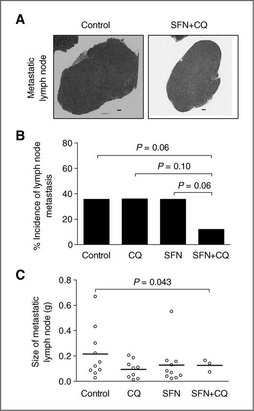 Figure 2. SFN and CQ combination treatment decreases lymph node metastasis in TRAMP mice. A, microscopic images depicting lymph node metastasis in a representative mouse each of the control group and the SFN + CQ group (magnification, ×5; scale bar, 400 μm). B, percentage of mice with lymph node metastasis. Statistical significance was determined by Fisher exact test. C, size of lymph node metastasis in mice of control group (n = 10), CQ alone group (n = 9), SFN alone group (n = 10), and SFN + CQ group (n = 3). Results shown are mean ± SD. Statistical significance was determined by Wilcoxon 2-sample test.