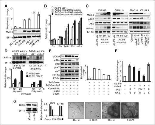 Figure 4. mda-9/syntenin enhances IGFBP-2 expression through c-Src- and AKT-dependent pathways. A, expression levels of IGFBP-2 in the indicated cell-derived conditioned media were determined by ELISA and the levels of MDA-9/syntenin protein in cell lysates were determined by Western blotting. EF-1α expression was used as a loading control. B, FM-516 cells were infected with either Ad.5/3-vec or Ad.5/3-mda-9 at different m.o.i. as indicated. At different time points, ELISA analyzed conditioned media for IGFBP-2 expression. C, FM-516 cells were infected with Ad.5/3-mda-9 and C8161.9 cells were infected with Ad.5/3-shmda-9 at the indicated multiplicity of infection and expression of the indicated protein was determined by Western blotting. D, FM-516 cells were infected with either Ad.5/3-vec or Ad.5/3-mda-9 and then treated or untreated with LY294002 (2.5 μmol/L) for 12 or 24 hours. Expression of HIF-1α and EF-1α were analyzed by Western blotting using cell lysates (top) and expression of IGFBP-2 was analyzed by ELISA in conditioned media (bottom). All experiments were carried out at least 3 times. E, Western blot analysis of the indicated proteins (left) and ELISA of IGFBP-2 in conditioned media (right) after transient knockdown of c-Src and FAK in FM-516 cells infected with Ad.5/3-vec or Ad.5/3-mda-9. F, FM-516 cells were infected with Ad.5/3-mda-9 and then treated with the pharmacologic inhibitor of c-Src PP2 or its inactive analog PP3 and IGFBP-2 expression was determined by ELISA. G, C8161.9 cells treated with either control siRNA or c-Src siRNA, and cell lysates and conditioned media were collected. Left, Western blot analysis of the indicated proteins in cell lysates. Middle, HUVECs were treated with conditioned media and tube formation was analyzed; Right, conditioned media was implanted in CAM and neovascularization was photomicrographed. Data represent mean ± SD.