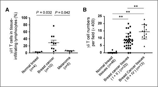 Figure 1. High percentages of γδ1 Tregs exist in TILs of patients with breast cancer. A, human breast TILs contained high percentages of γδ1 T cells (4%–77%; mean, 29.1%), whereas in normal breast tissue-infiltrating T cells and melanoma, TILs only have few γδ1 T-cell populations (2%–4%; mean, 2.8%; 3%–8%; mean 5.8%, respectively). TILs and normal tissue-infiltrating lymphocytes were isolated from freshly digested tissues and γδ1 T-cell populations analyzed by flow cytometry. B, significantly increased numbers of γδ T cells existed in breast cancer tissues with early stages (I + II) and late stages (III + IV) compared with those in normal breast tissues. Frozen sections from breast tumor samples and controls of paired normal breast tissues (n = 46) were immunohistochemically stained to detect γδ T cells. The number of γδ T cells shown is the average numbers per high field (×400) in each tissue sample. The mean number of γδ T cells in each group is shown as a horizontal line. Significance was determined by paired t test (breast cancer vs. normal breast tissues) or unpaired t test (early stages vs. late stage of breast cancer tissues). **, P < 0.01.