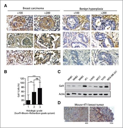 Figure 1. Gal1 expression in breast cancer. A, immunohistochemistry of human breast tumors (n = 55) histologically classified according to the Scarff–Bloom–Richardson grading system, Grade I (n = 16), Grade II (n = 24), and Grade III (n = 15) as well as benign mammary hyperplasia (n = 7). Tissue sections were stained with a polyclonal anti-Gal1 Ab or hematoxylin and eosin. Representative micrographs are shown. B, percentage of Gal1-positive cells in at least 10 fields (×200). **, P < 0.01 Grade I versus II and ***, P< 0.001 Grade I versus III, Kruskal–Wallis and Dunn multiple comparison test. C, immunoblotting of Gal1 and Actin in human (T47D, MCF-7, and MDA-MB-231) and mouse (4T1 and C4HD) breast cancer cell lines and mouse normal breast tissue (MNB). A representative experiment of a total of 4 experiments is shown. D, representative micrographs of mouse 4T1 tumors stained for Gal1 (×40 and ×100).