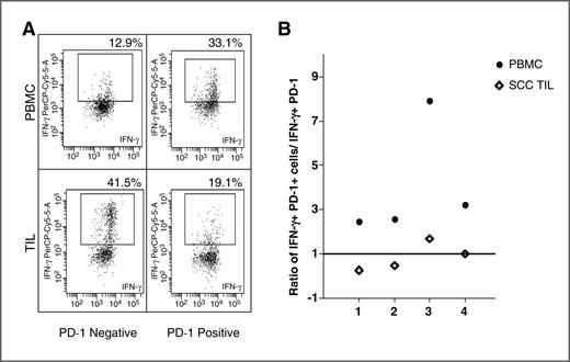 Figure 6. PD-1–expressing CD8+ TILs are functionally anergic relative to peripheral blood PD-1–expressing T cells. A, representative flow cytometry comparing IFN-γ production by CD8+ T cells sorted by PD-1 expression in PBMCs and TILs and stimulated with PMA/ionomycin. B, summary graph of the ratio of IFN- γ production by PD-1(+) to PD-1(−) TILs and peripheral blood in response to PMA/ionomycin. A value greater than 1 indicates increased IFN-γ production in PD-1(+) compared with PD-1(−) T cells, and a value less than 1 indicated a reduction. •, PBMC; ⋄⋄⋄⋄⋄, TILs.