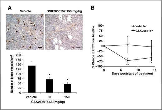 Figure 5. Vascular effects of GSK2656157 in tumor xenografts. A, effect on vascular density. BxPC3 tumor-bearing mice were treated twice daily for 21 days with GSK2656157. Tumor sections were analyzed for vascular density using immunohistochemistry for MECA and vWF (scale bar, 15 μm). Data in the graph represent mean ± SE (n = 4 mice/group); *, P < 0.05 (t-test). B, effect on vascular perfusion. Percentage changes inKtrans values from baseline DCE-MRI is shown as mean ± SE (n = 5 for GSK2656157; n = 6 for vehicle). Statistical analysis was conducted on the absolute median Ktrans values using one-way ANOVA with post hoc Bonferroni test. **, P < 0.01; *, P < 0.05.